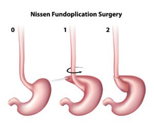 Minimally_Invasive_and_Endoscopic_Surgery