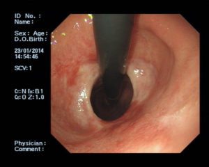 Endoscopy_and_General_Surgery