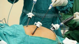 Endoscopy_and_General_Surgery