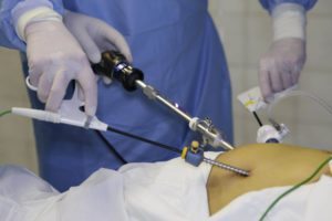 Minimally_Invasive_and_Endoscopic_Surgery
